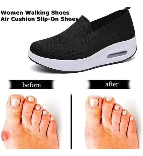 Zapatillas Ortopédicas Para Mujer,sandalia Deportiva De Mall